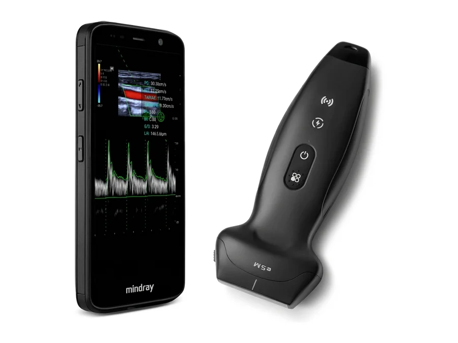 Ultrassom TE Air e5M (Portátil)