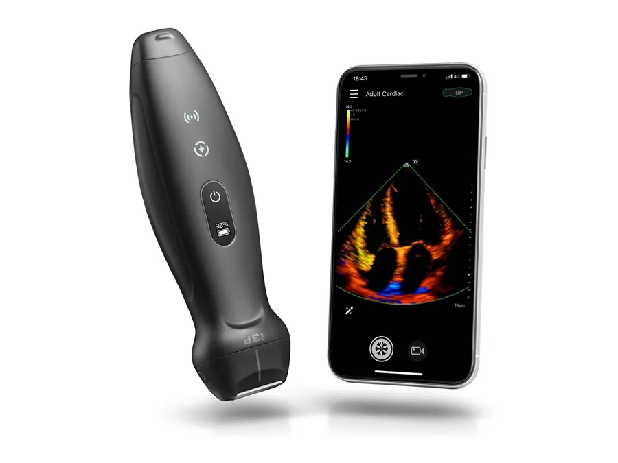 Ultrassom TE Air I3P (Portátil)